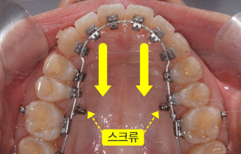 전체 후방이동