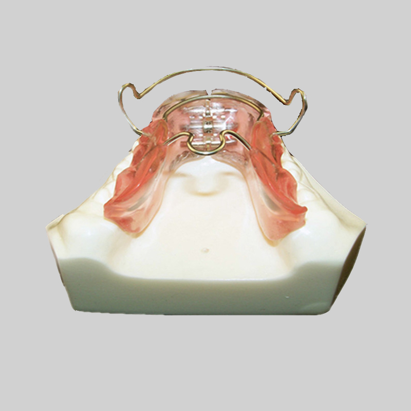 무턱교정